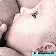 Breast engorgement or congestion