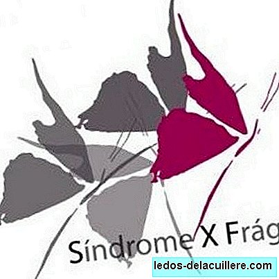 Δωρεάν ημέρες για το σύνδρομο Fragile X