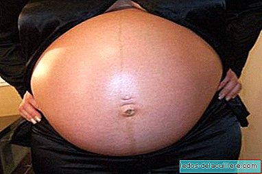 Gestacijski dijabetes obično se ponavlja u kasnijim trudnoćama