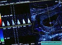 Doppler ultrasound in the control of pregnancy