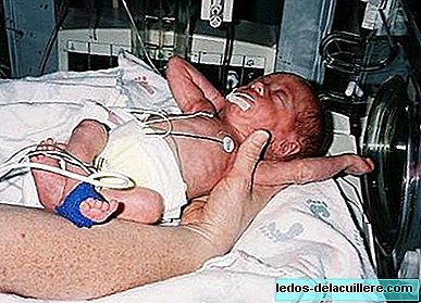 De leeftijd van premature baby's moet gedurende de eerste twee jaar worden gecorrigeerd