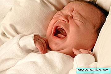 Stenosis Lacrimal bagi bayi baru lahir
