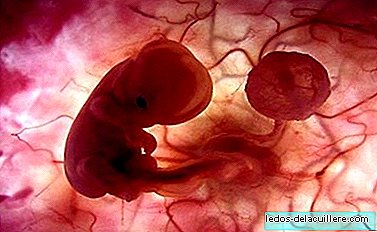Oplodnění in vitro zvýhodňuje narození kojenců
