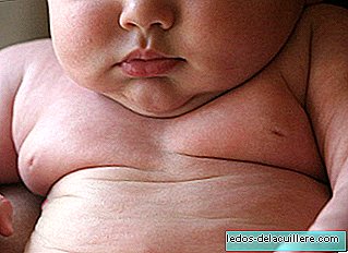 Obezitatea copilului ar putea fi cauzată de o genă