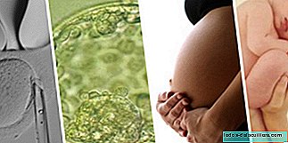 Потпомогнута репродукција и ризик од појаве малформација