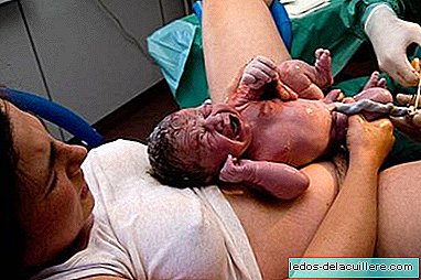 Placental transfusion and the position of the baby at birth
