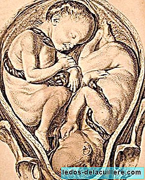 The return of umbilical cord in the neck of the fetus