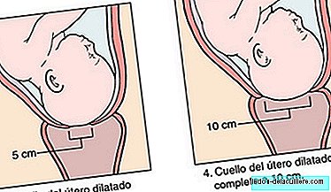 As fases do trabalho de parto: dilatação ativa