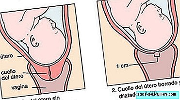Les phases de l'accouchement: dilatation précoce ou latente