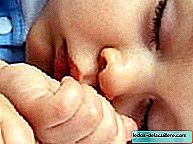 Keuchen ist eine der häufigsten Ursachen für pädiatrische Konsultationen