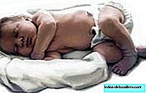 Bebês pequenos ao nascer são mais propensos ao excesso de peso na infância