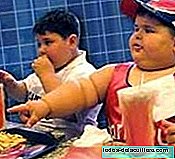 I bambini obesi hanno un rischio maggiore di avere una frattura