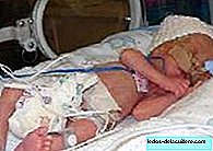 Mehanički respiratori kod vrlo prijevremeno rođene djece mogu razviti oštećenje pluća