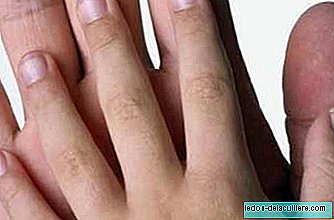 Witte vlekken op de nagels
