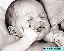 新生児の鼻水