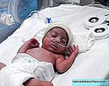 Musicoterapia em bebês prematuros