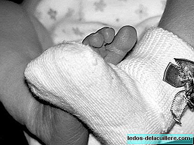 Ein Baby mit zwei Köpfen wird in China geboren