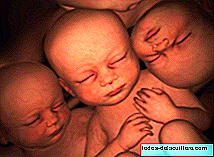 Identical triplets are born, a rare case