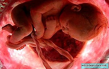 Operacija srčne bolezni znotraj maternice