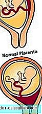 Previous placenta