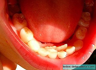 Откъде идват окончателните зъби?