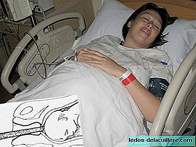 Interventions de routine possibles lors de l'accouchement à l'hôpital: amnioscopie