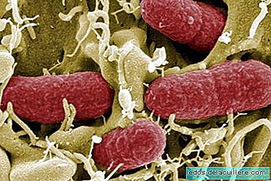 What is E.Coli and how to prevent infection in children?
