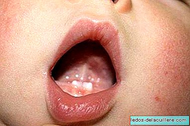 Nguy cơ của một số loại thuốc cho đau mọc răng
