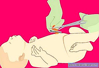 Leichte Nabelblutung des Neugeborenen