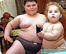 Apakah obesitas anak akan dianggap kelalaian?