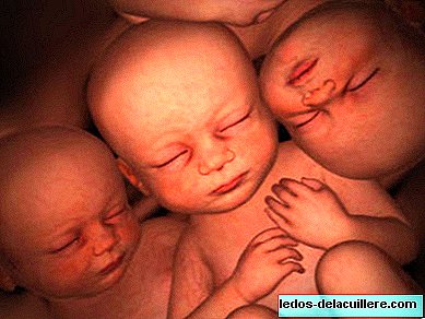 Singular pregnancy of identical triplets