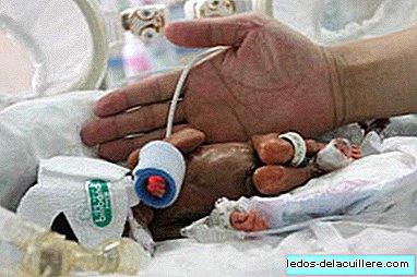 Chinese baby survives 413 grams and 26 centimeters