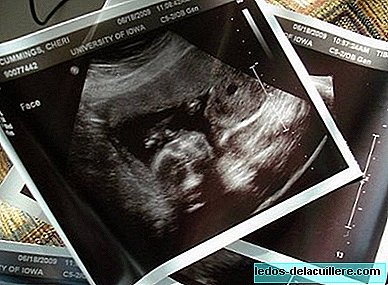 Texas navrhuje, aby bylo srdce plodu slyšeno před potratem