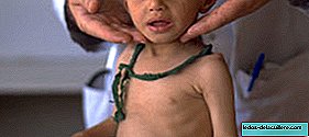Thuis behandelen van kinderen met longontsteking is een effectieve maatregel zoals aangegeven door de WHO