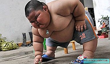 3 yaşındaki Çinli bir çocuk 60 kilo ağırlığında