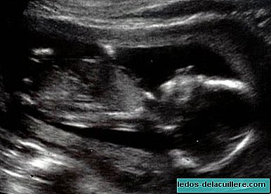 Um casal faz uma pesquisa on-line para decidir se deve dar à luz ou abortar