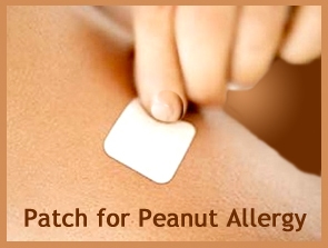 Cura pentru alergia la arahide cu un pas mai aproape