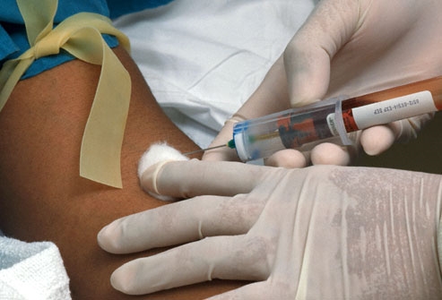 Δοκιμές αίματος κατά τη διάρκεια της εγκυμοσύνης: αυτά για τα οποία γίνονται