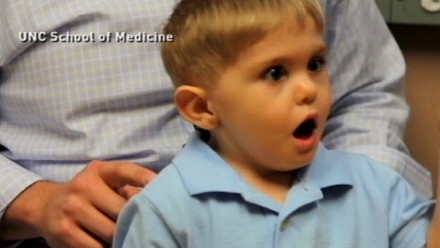 เด็กคนแรกในสหรัฐอเมริกาที่ได้รับการปลูกถ่ายก้านสมองสามารถได้ยิน