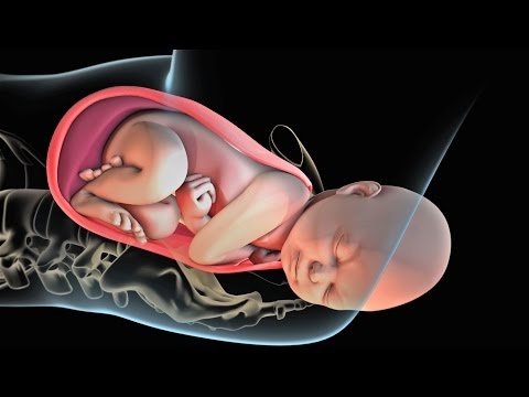 Sünnitage austusega: video sellest, mis ei tohiks sünnitusel juhtuda
