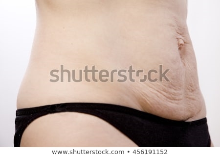 How is the belly after childbirth
