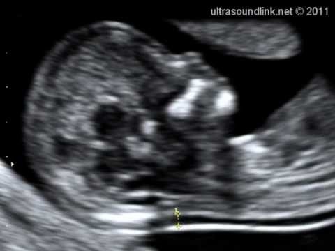 Womb Tube: dela resultatet av graviditetstestet på video