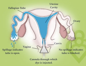Womb Tube: แบ่งปันผลการทดสอบการตั้งครรภ์ในวิดีโอ