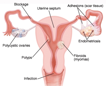 Problems that can affect the uterus