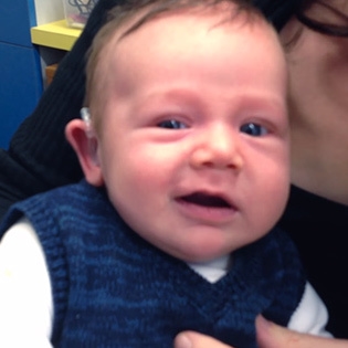 En döv babys ansikte när den hörs för första gången