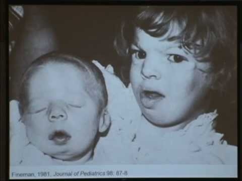 Video: dvojčka, rojena po premagovanju raka