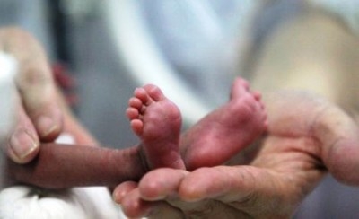 Premature birth: survival, difficulties and sequelae