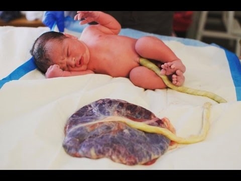 Birth lotus: leave your baby attached to the placenta for nine days after birth