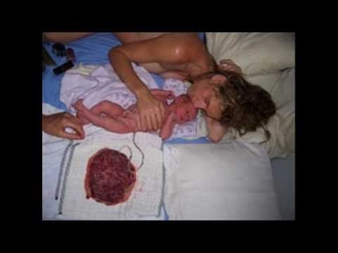 Loto alla nascita: lascia il tuo bambino attaccato alla placenta per nove giorni dopo la nascita