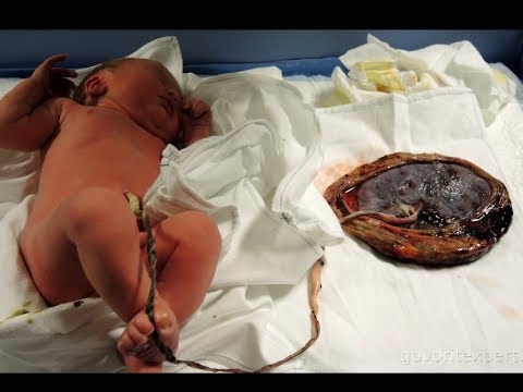 Лотос при рождении: оставьте своего ребенка прикрепленным к плаценте на девять дней после рождения